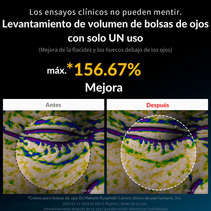 Dr. Melaxin™ Eyephalt Crema para eliminar bolsas ojeras