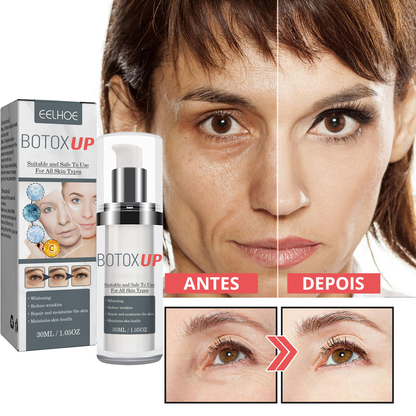 Suero antienvejecimiento Botox-UP™ Efecto Botox sin aguja + Aclarador de imperfecciones