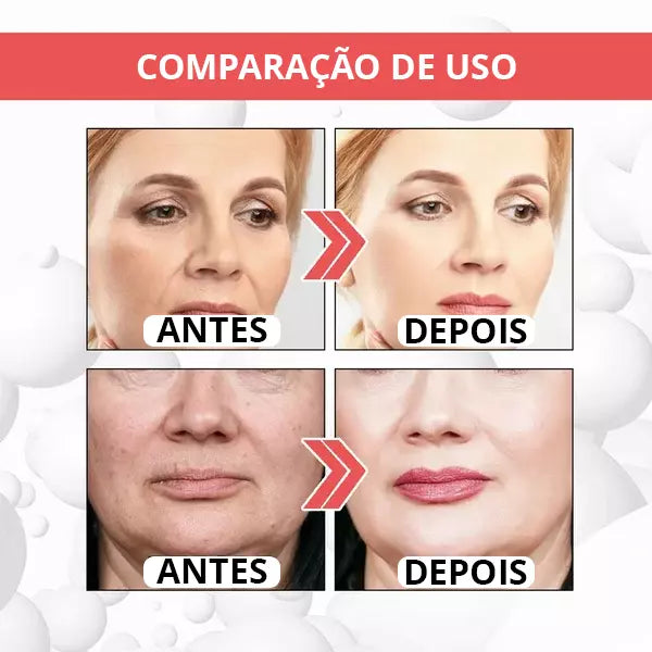 Suero antienvejecimiento Botox-UP™ Efecto Botox sin aguja + Aclarador de imperfecciones