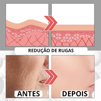 Suero antienvejecimiento Botox-UP™ Efecto Botox sin aguja + Aclarador de imperfecciones